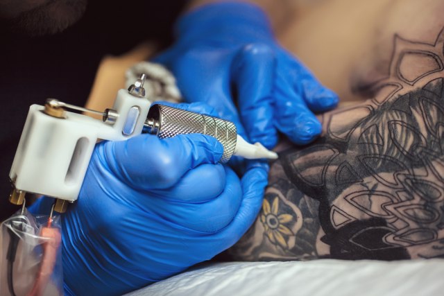 Alergijska reakcija na tetovažu može da se javi i posle 20 godina